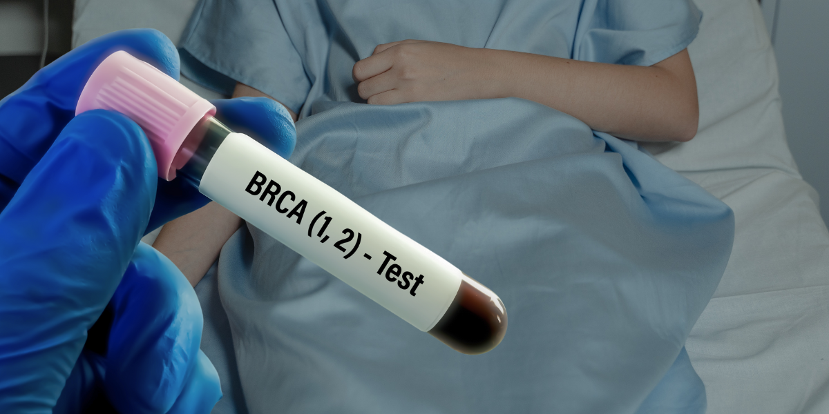 A test tube with blood labeled BRCA (1, 2) - Test