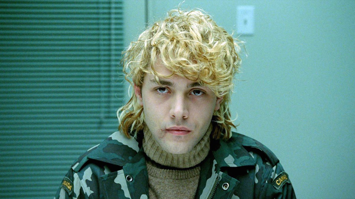 A close up of Xavier Dolan with dyed blonde hair and a beat up face. 